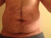 letting gut hang loose