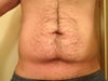 sucking in gut