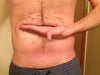 sucking in gut and lifting skin, i would like my abdomen to look like this after whatever procedure i have done (roughly)