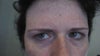 My brows and eyelids