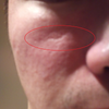 2 months after restore.. Little to no improvement. Will i see better result on my next treatment? 
(Asian skin, Olive, fair, combination dry and oily)