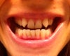 Lower teeth view