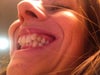 Baby tooth