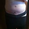 Here you can see the soft bubble a lot, this photo idoesn't show the flank excess but it is there Thank you for any advice!