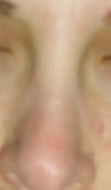 close up front