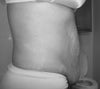 tummy