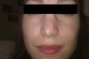 Frontal