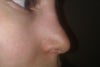 leftside
