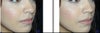 nose before on left and morph on right