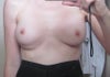 6 months post op flexing