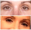 Not even makeup can hide under eye hollows.