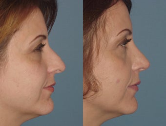 Female, Late 30's
