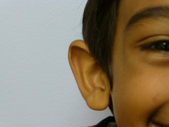 Childs otoplasty