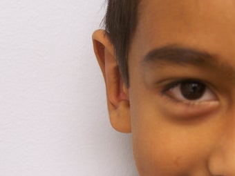 Childs otoplasty
