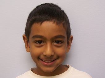 Childs otoplasty