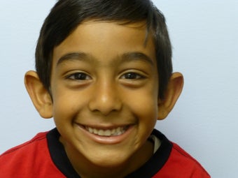 Childs otoplasty