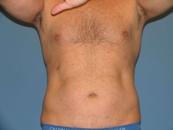 Exilis