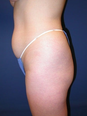 40 year old female, 5'4" 137 lbs.