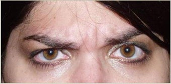 Botox