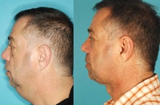 Chin and Neck