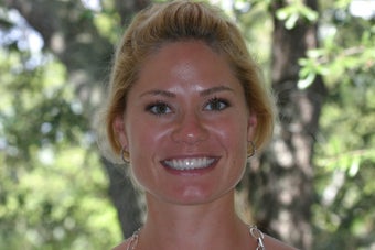 Short, Discolored Teeth Treated with da Vinci Porcelain Veneers