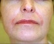 53 year old female patient 