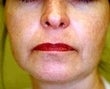 53 year old female patient 