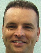 FUE-BHT hair transplantation using head and body hair