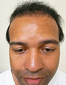 UE – BHT by SFET Using Beard and Chest Hair