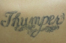 Laser Tattoo Removal