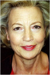 Facelift, Endoscopic Forehead Lift, Quadrilateral Blepharoplasty