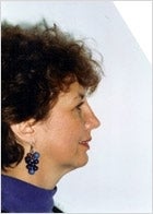 Rhinoplasty
