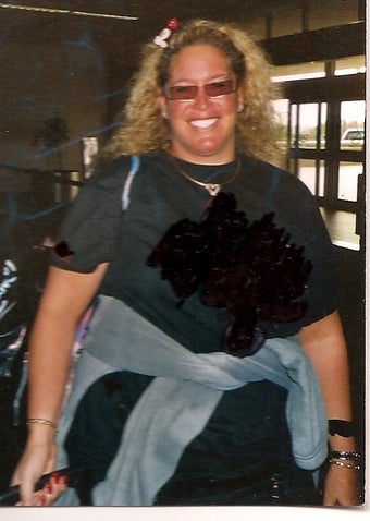 Gastric Bypass