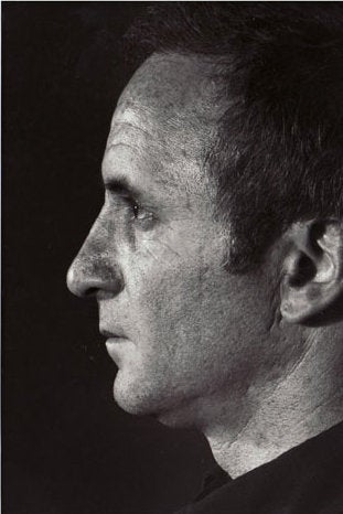 Rhinoplasty