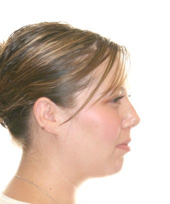 Surgical Orthodontics