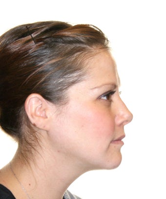 Surgical Orthodontics
