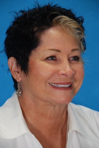 Botox and Juvederm