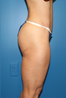 Del Mar butt tuck