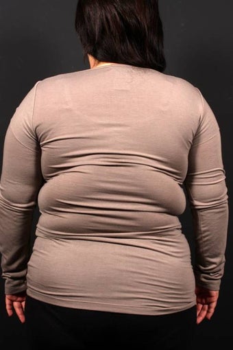 Bra Line Back Lift