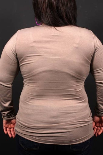 Bra Line Back Lift
