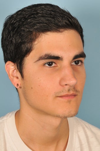 Gauged Earlobe Repair