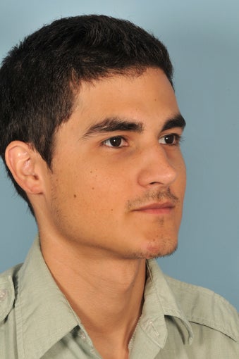 Gauged Earlobe Repair