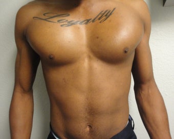 Pectoral Implants