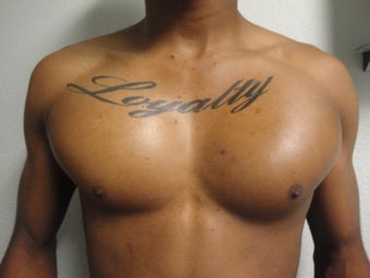 Pectoral Implants
