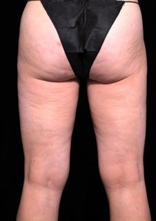 Cellulaze