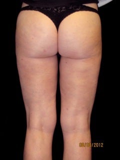 Cellulaze