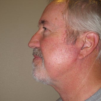 Necklift