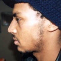 African American Rhinoplasty