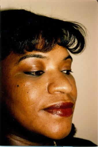 Rhinoplasty