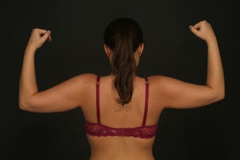 Arm Lift